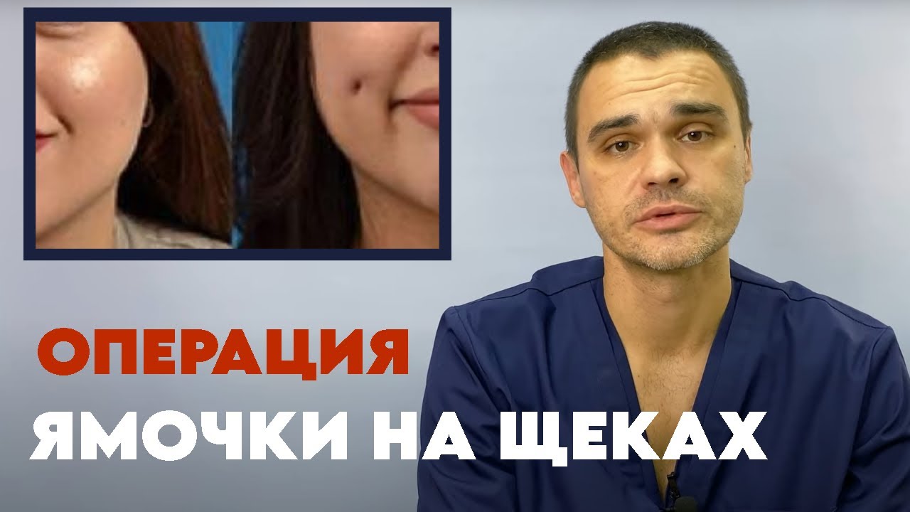 Ямочки на щеках | Как проходит операция? #пластическийхирург #доктор