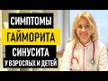 Симптомы гайморита у взрослых и детей. Признаки синусита, фронтита, этмоидита и сфеноидита