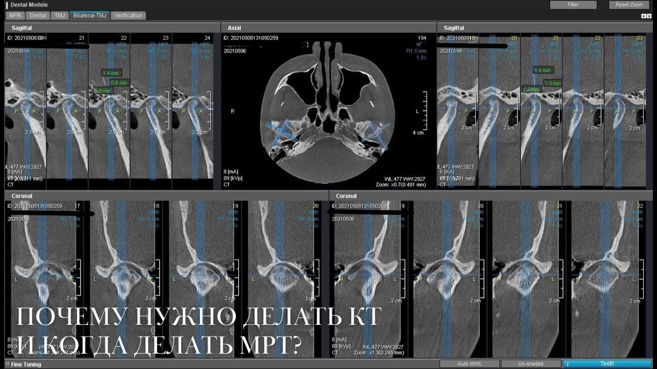 Можно 2 раза делать кт