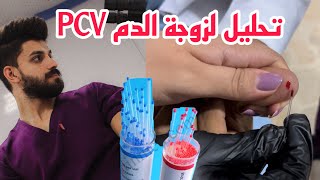 تحليل لزوجة الدم PCV علي السماري شرح ماهي اللزوجة وكيف نشتغل هذا التحليل بالمختبر