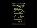 آموزش مود های تهویه مصنوعی نوزاد قسمت 1 Neonatal mechanical ventilation modes part 1