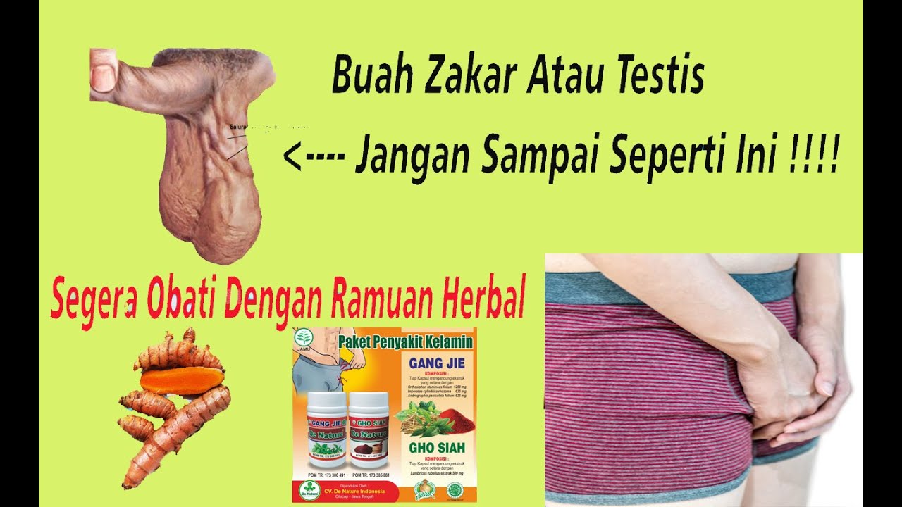 Nama obat buah zakar membengkak di apotek terdekat.. YouTube