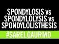 Spondylosis vs. Spondylolysis vs. Spondylolisthesis