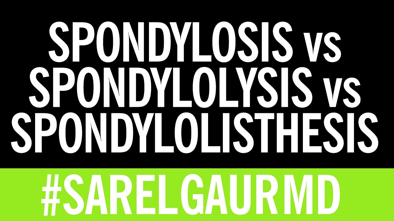 Spondylolisthesis vs spondylolysis vs spondylosis