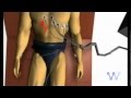 تخطيط القلب الكهربائي مبادئ أساسية ECG Basic P 