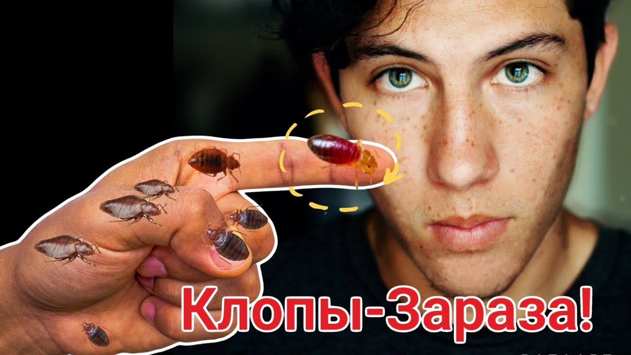 Постельные клопы! Вам говорили неправду! Реальные Факты! - YouTube