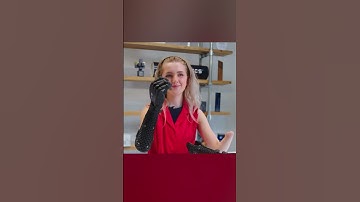 Deze bionische arm werkt zelfs los