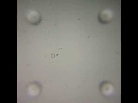Seemで撮影した運動率33 3 の精子動画 Youtube Seemで撮影した運動率33 3 の精子動画 Youtube