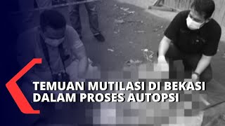 Download lagu Potongan Tubuh di Depan Bengkel Tambal Ban Gegerkan Bekasi, Kini Lanjut Uji Forensik di RS Polri