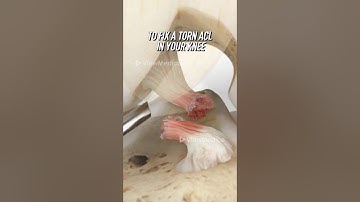 ACL reconstruction using your own tendon (3D Animation)