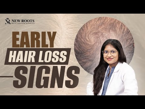 STOP Ignoring These Early Hair Loss Signs! 😨 | Hair Loss Explained | New Roots