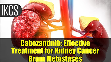 Cabozantinib: Effective Treatment for Kidney Cancer Brain Metastases