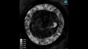 Patient-Derived Human Lung Organoids - 3D Scanning