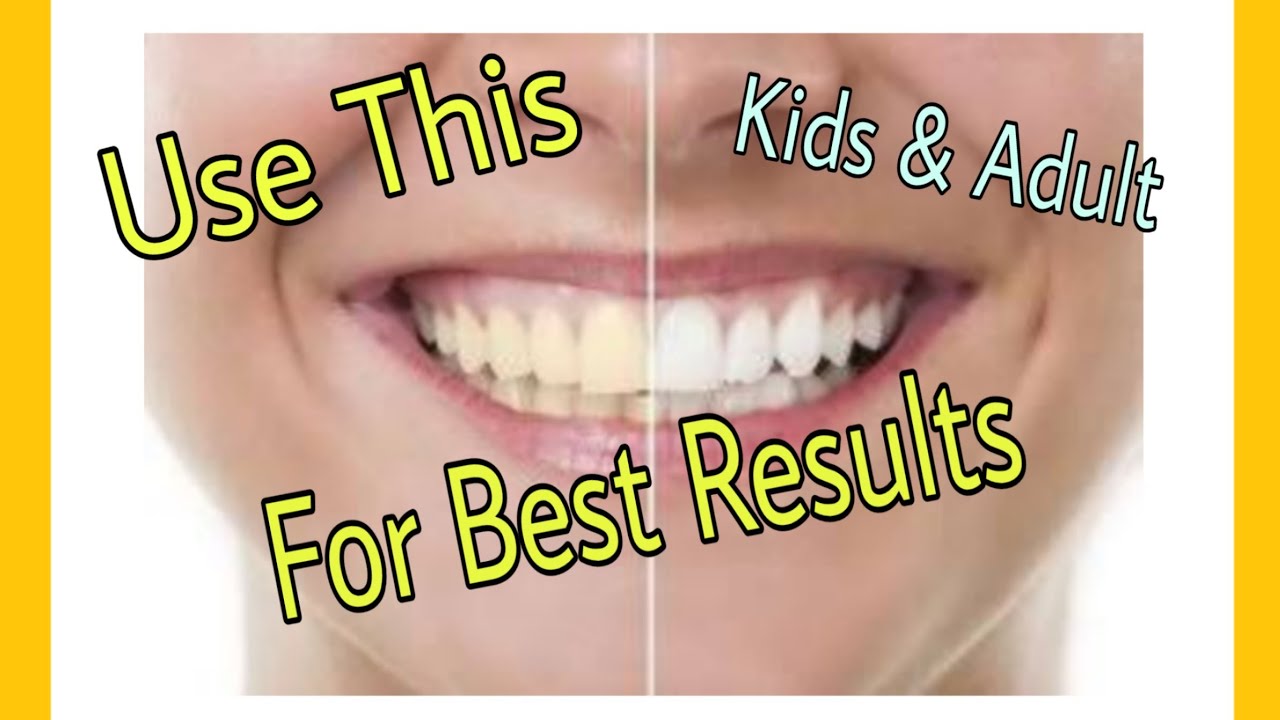 Best Toothpaste Yellow Teeth/Gums/Tooth Problems (Honest Review
