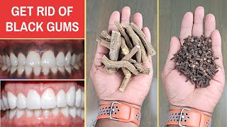 Reverse Black Gums Naturally | Best Remedy To Treat Black Gums Naturally
