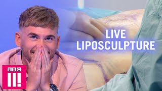 Watching A Live Liposculpture Procedure - Would You Have It Done? | Plastic Surgery Undressed