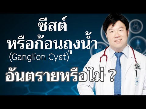 วีดีโอ: 3 วิธีในการรักษา Pilonidal Cyst