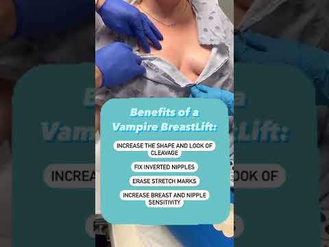 Vampire Breast Lift at GLOW!