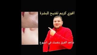 احسن كريم لتفتيح البشرة  في اسبوع  بدون اثار جانبية بسعر مفاجأة@ahmedkhamis1039