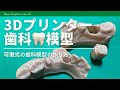 【歯科技工】Formlabs form2 3D プリンターを使った歯科用模型の作り方