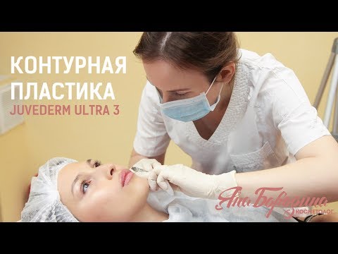 Video: Juvederm-injektioner - Recensioner, Applikation, Kontraindikationer