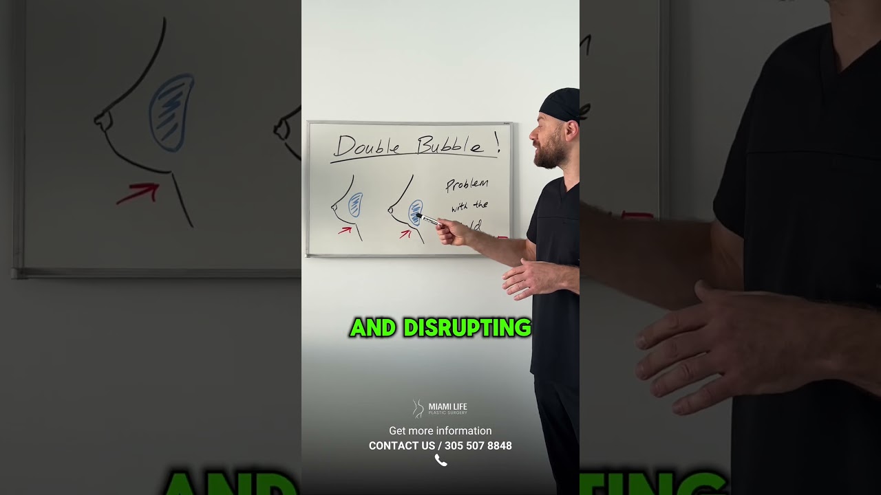 Double Bubble - Breast Augmentation