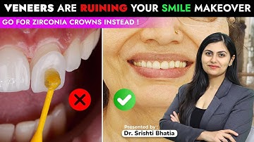 Veneers Are RUINING Your Smile Makeover! Go for Zirconia Crowns instead! Dr. Srishti Bhatia #smile