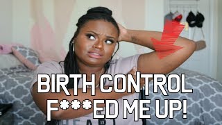 I GAINED 50 POUNDS ON BIRTH CONTROL | Depo Shot and Nexplanon Arm Implant