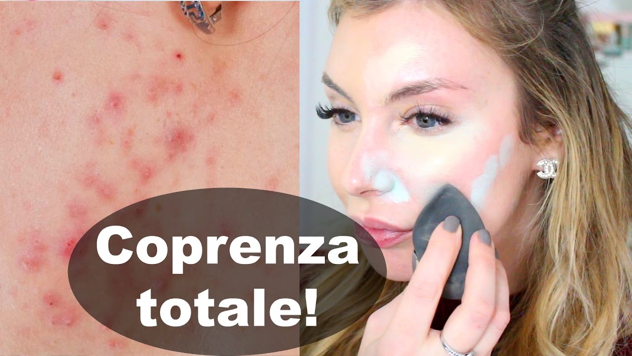 maschere viso per acne