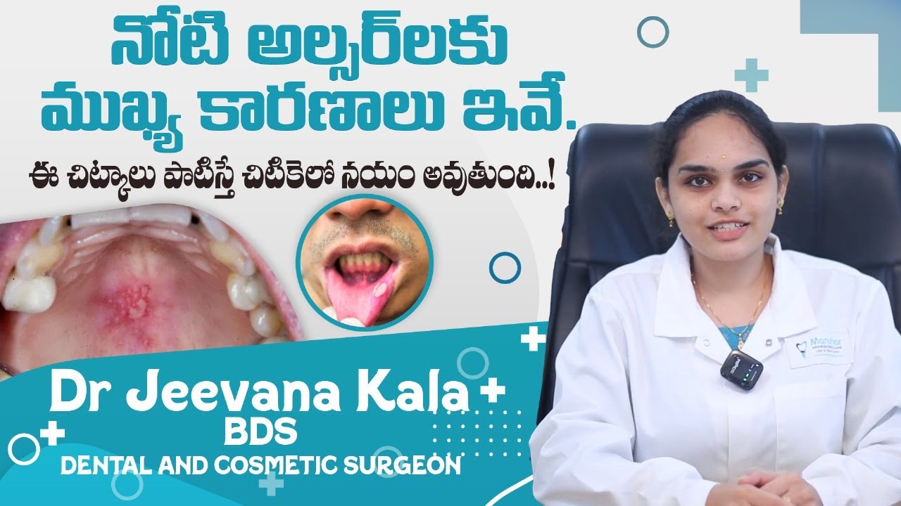 నోటి పూత వల్ల ఏమి తినలేకపోతున్నారా ? | Causes of Mouth Ulcers in Telugu  | Manohar Dental