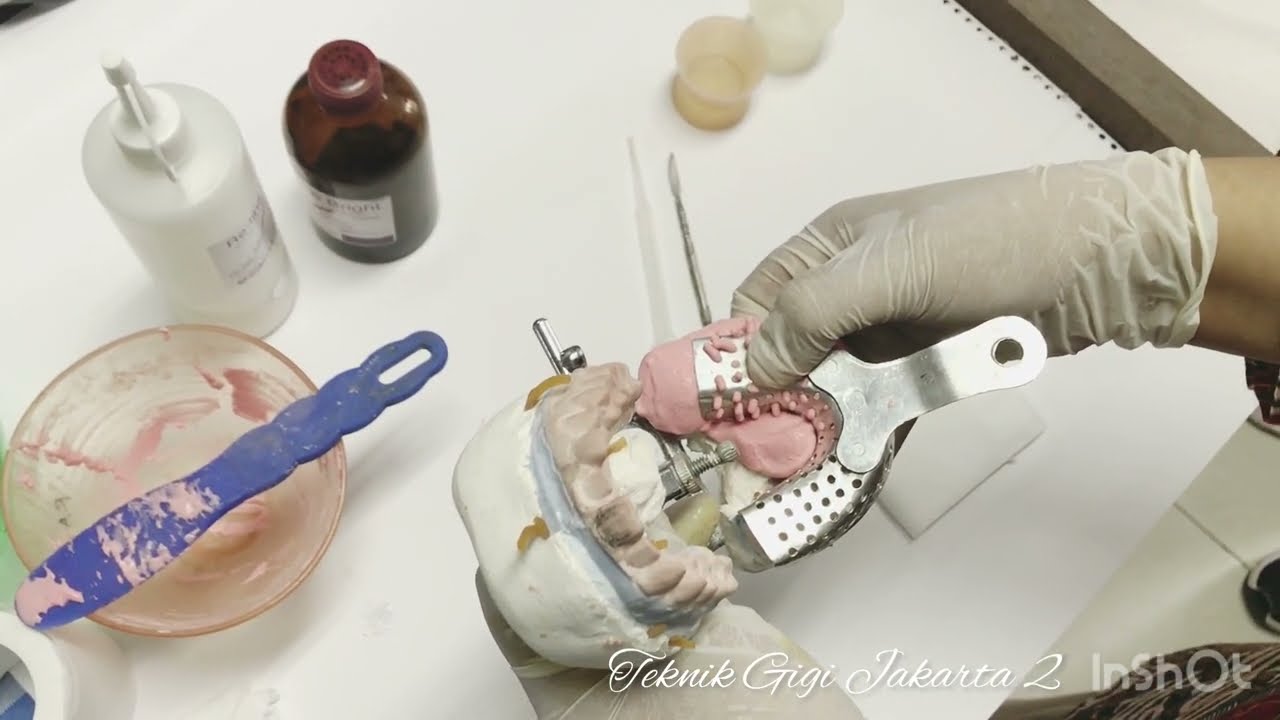 Pembuatan GTC Resin bahan Self Curing (Indirect)