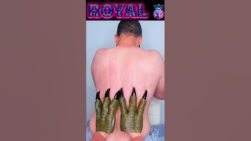 Rookie VS Royal Back Scratch | You Choose #shorts #short #viral