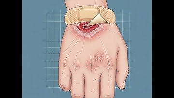 Dấu hiệu cảnh báo sớm bệnh tiểu đường bạn không nên bỏ qua | Sức Khỏe Đường Huyết