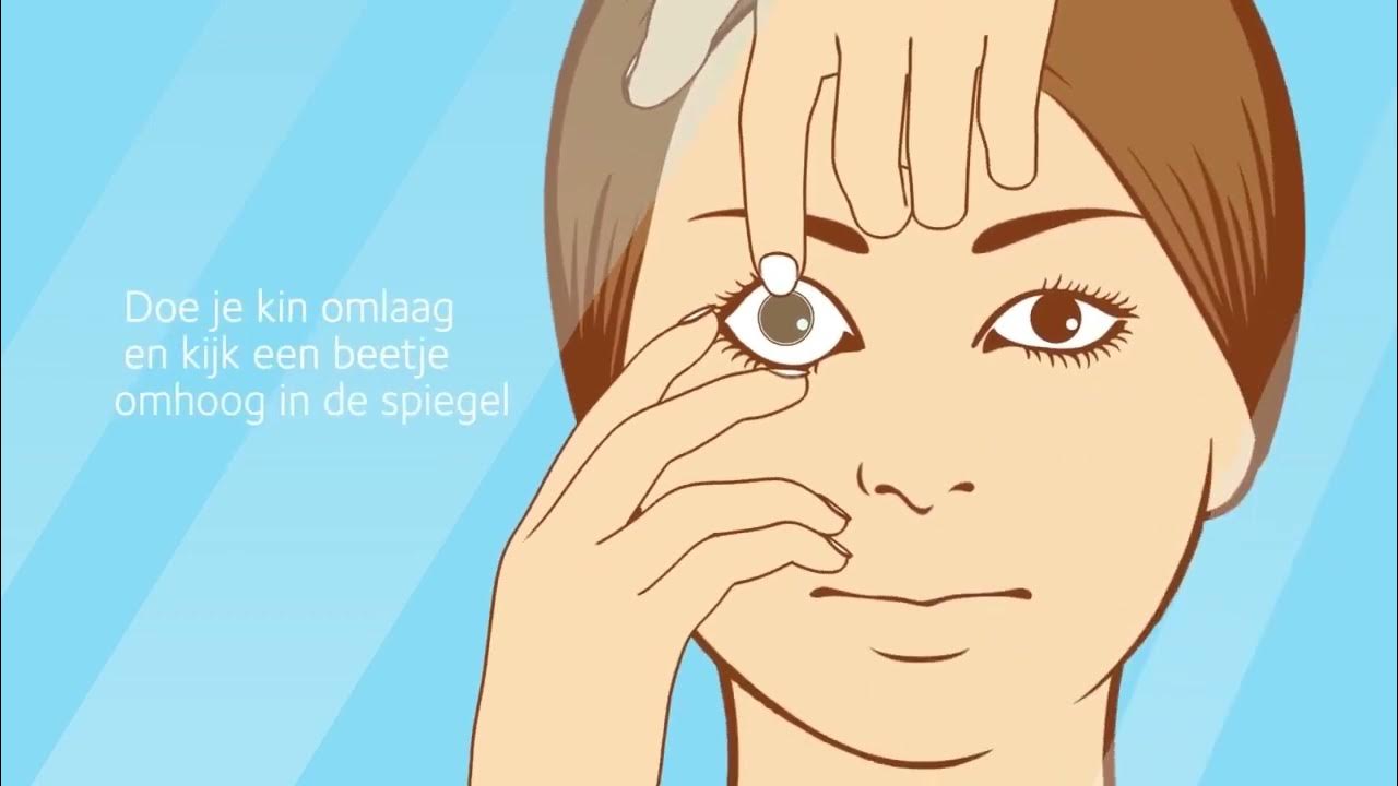 kosten lenzen specsavers