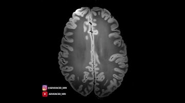 This is the highest resolution MRI scan  of the whole human brain to date