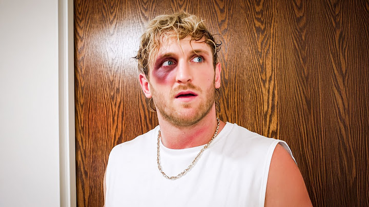 I Got Punched In The Face **Not Clickbait**
