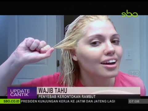 sbo tv digital PENYEBAB RAMBUT RONTOK