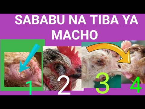 Video: Je, magonjwa yanaweza kuwa kichwani mwako?