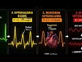 One electrolyte can stop the heart — Hyperkalemia 💀
