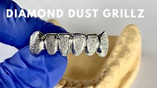 Diamond Dust Grillz