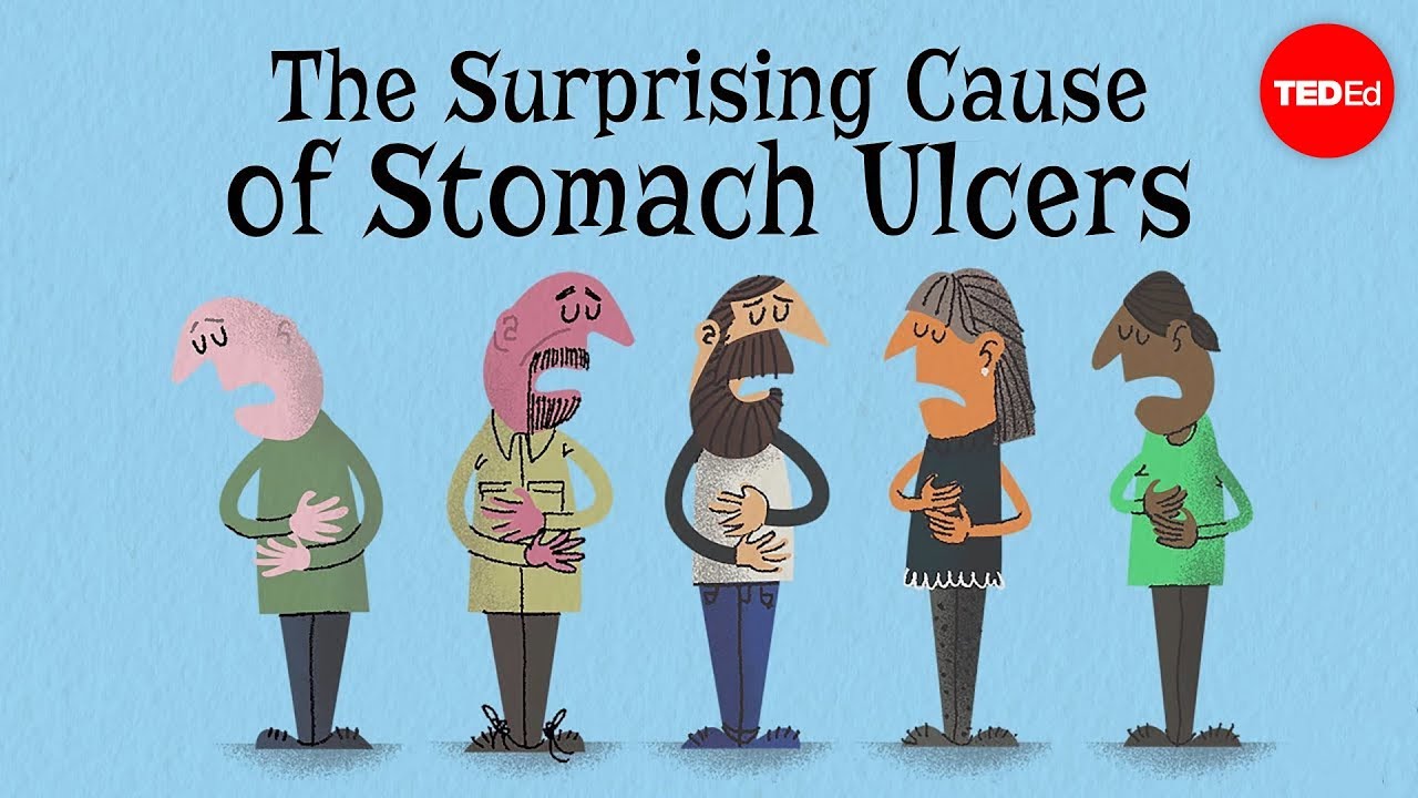 The Surprising Cause Of Stomach Ulcers - Rusha Modi