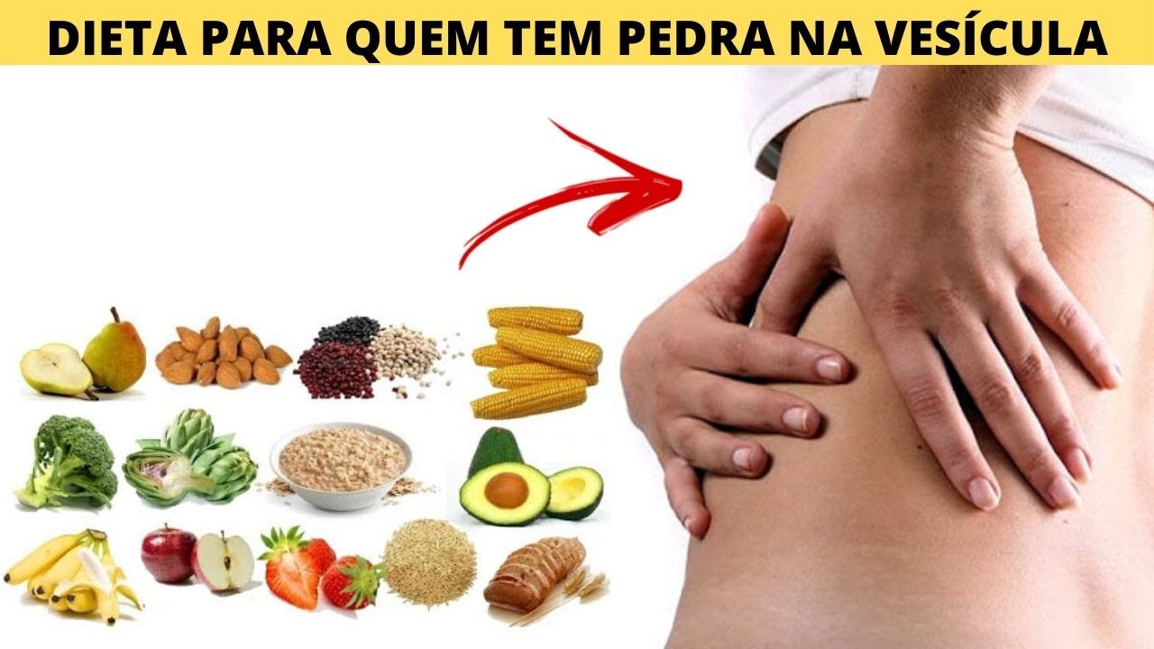 Dieta para quem tem pedra na vesicula - YouTube