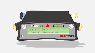 Unresponsive LVAD Algorithm