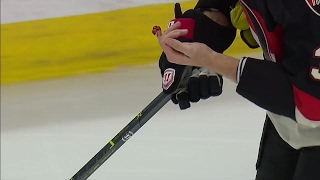 Methot gruesome injury exposed lack of protection in gloves