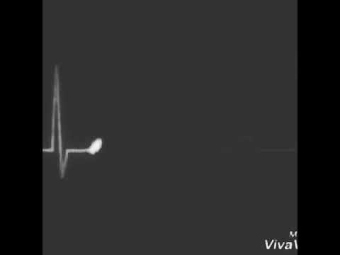 Esmah Hüzünlü Klip 