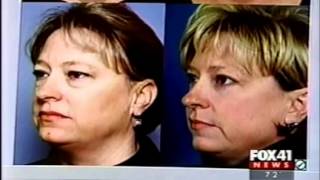 Dr. Calobrace Gives Plastic Surgery Advice on FOX 41 News