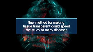 New method for making tissue transparent could speed the study of many diseases