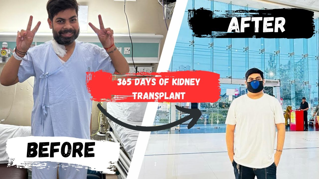 1 Year After My Kidney Transplant: The First 365 Days of My Journey 