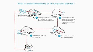 What is Rat Lungworm (Angiostrongylus) Disease? thumbnail