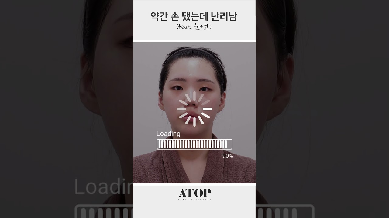 [A-TOP 整形外科] 微調了一下就爆紅了 (眼部+鼻部)